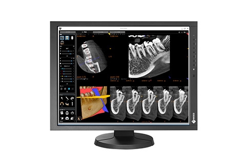 Eizo-Radiforce-MX215-clinical-review-monitor-staande-stand-St