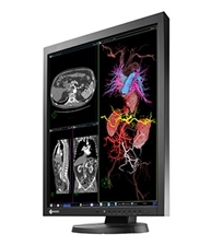 Eizo-Radiforce-MX215-clinical-review-monitor