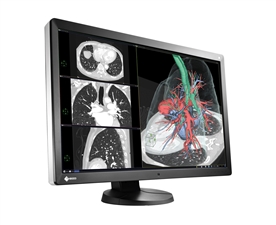 Eizo-Radiforce-RX650-diagnostische-schermen-van-2MP-tot-8MP