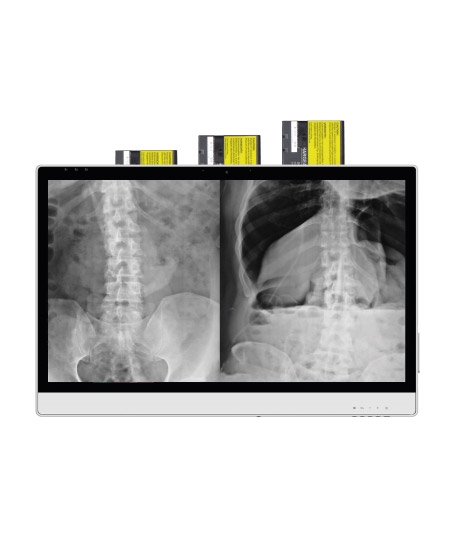 DT-724-medische-monitor-accucellen-batterijen-antimicrobieel-ST