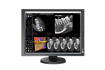 Eizo-Radiforce-MX215-clinical-review-monitor-liggende-stand-4-3