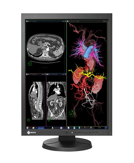 Eizo-Radiforce-MX215-clinical-review-monitor-staande-stand-St