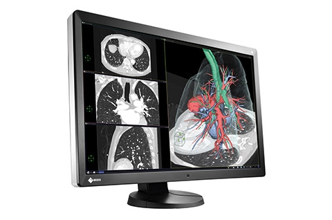 Eizo-Radiforce-RX650-diagnostische-schermen-van-2MP-tot-8MP-4-3