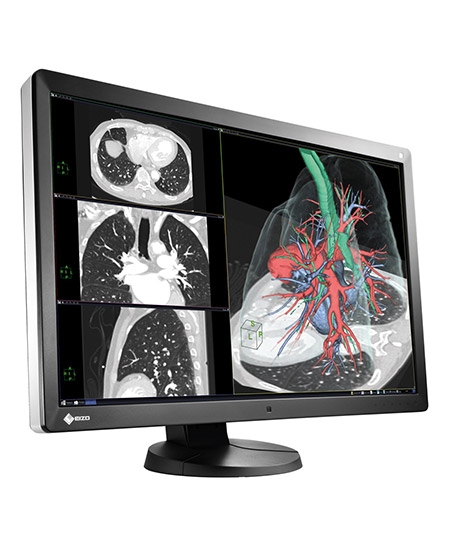 Eizo-Radiforce-RX650-diagnostische-schermen-van-2MP-tot-8MP-St