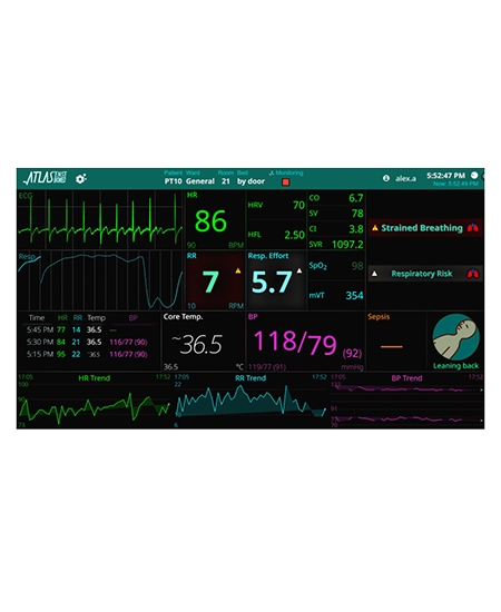 Parameters-St